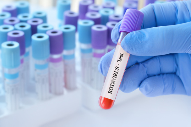 医療検査管の背景にRotaウイルス検査付きの血液サンプルチューブを分析付きで保持する医師. - 写真・画像