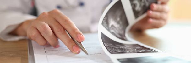 Gynecologist examines results of examination of uterus. Ultrasound diagnostics of pelvic organs - Фото, зображення