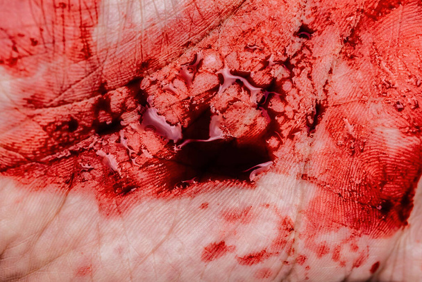 Las manchas de sangre en las manos - Foto, Imagen