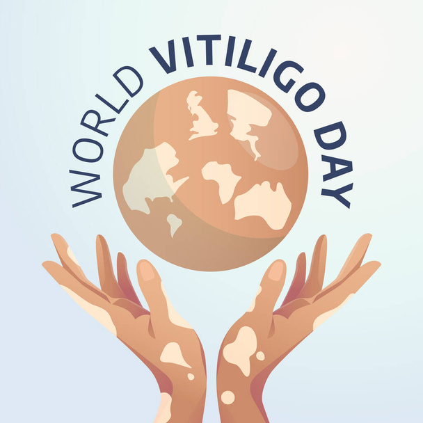 vector graphic of World Vitiligo Day good for World Vitiligo Day celebration. flat design. flyer design.flat illustration. - Vector, Image