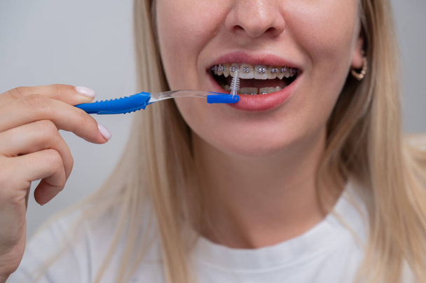 Caucasian woman cleaning her teeth with braces using a brush. Cropped portrait - Fotografie, Obrázek