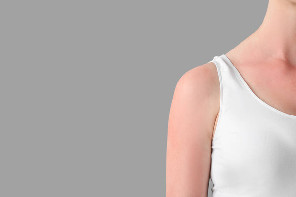 Allergic young woman with sunburned skin on grey background, closeup - Photo, Image