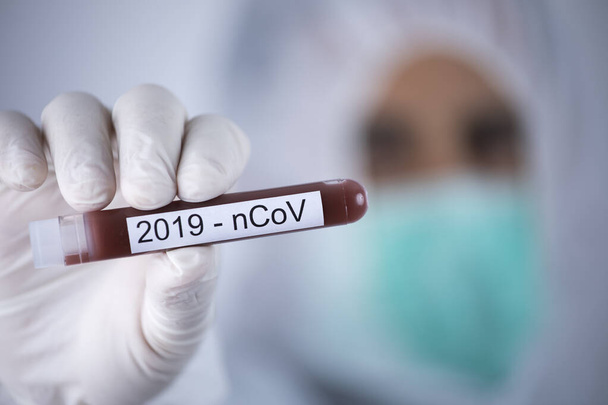 Arzt hält Reagenzglas mit Blut für Coronavirus-Test - Foto, Bild