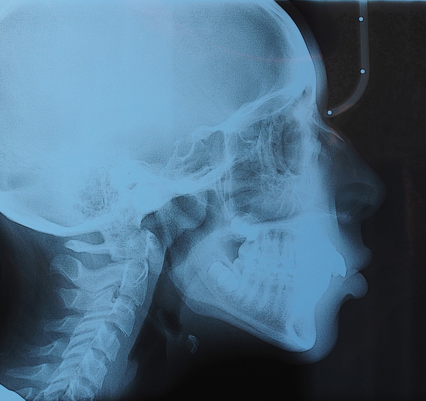 Медицинский рентген
 - Фото, изображение