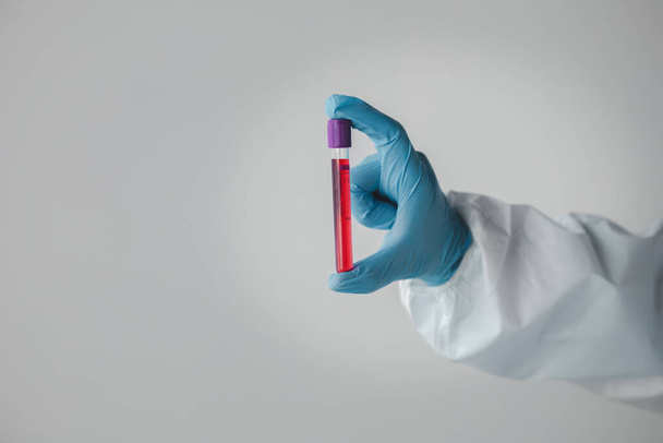 研究室では、病院の患者を採取し、患者から血液サンプルを採取することで得られた血液を検査・研究するための科学的研究に利用されています。研究室概念. - 写真・画像