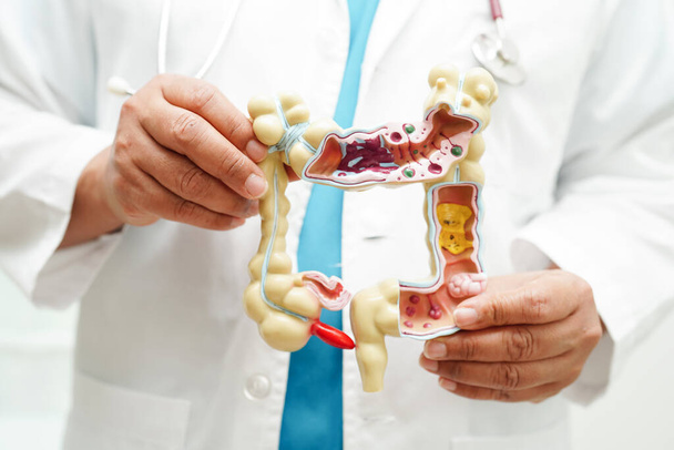 Intestine, doctor holding anatomy model for study diagnosis and treatment in hospital. - Photo, Image