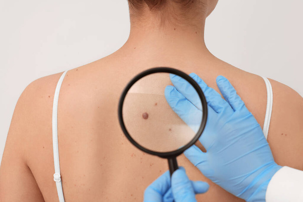 Dermatologist examining patient's birthmark with magnifying glass on beige background, closeup - Photo, image