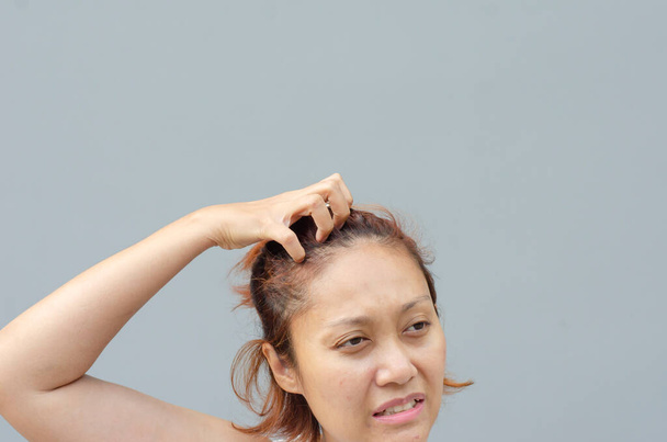 jovem mulher asiática coçar coceira com a mão na cabeça ou área do cabelo, conceito de cuidados de saúde, dermatose - Foto, Imagem