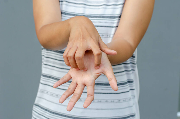 młoda azjatycka kobieta drapanie swędzenie z ręki na powierzchni dłoni, koncepcja opieki zdrowotnej, dermatoza - Zdjęcie, obraz