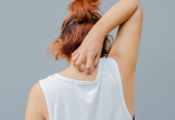 Юна азіатка подряпує свербіж руками на верхній частині спини, концепцію медичного обслуговування, дерматоз. - Фото, зображення