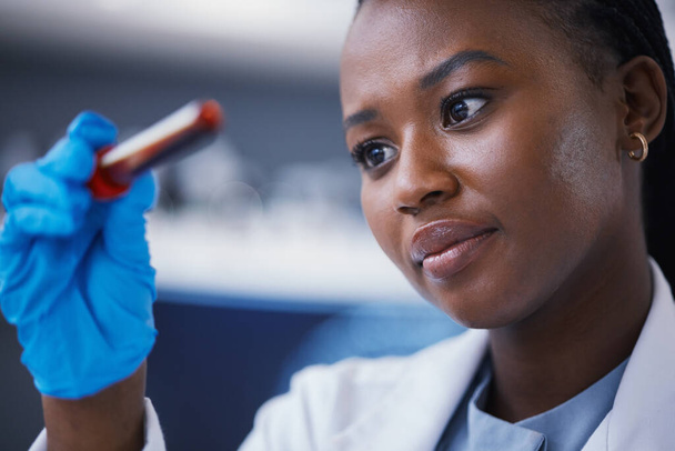 医学実験、テストまたは試験に取り組む研究室の科学、血液バイアルと女性科学者。生物学、医薬品、アフリカの女性研究者が研究室で科学的研究を行う - 写真・画像