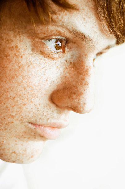 Az ember arcán szeplőkkel - Fotó, kép