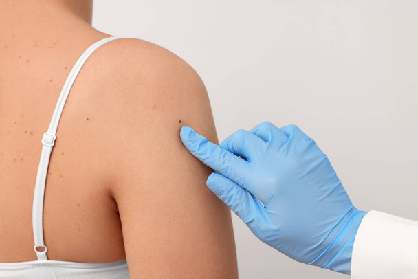 Dermatologist examining patient's birthmark on beige background, closeup - Foto, Imagem