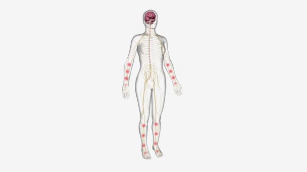 Центральна сенсибілізація, процес, при якому центральна нервова система обробляє біль та інші сенсорні стимули - Кадри, відео
