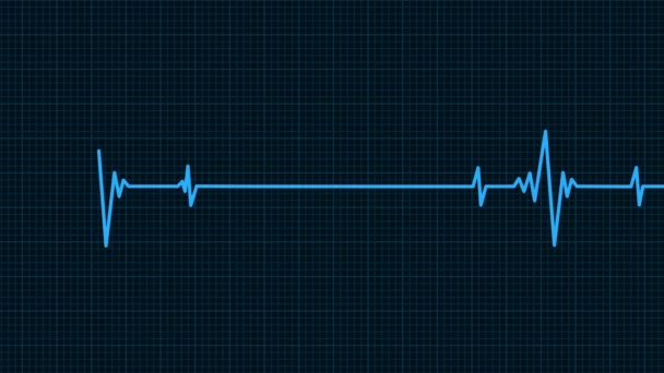 Heartbeat Monitor linea di frequenza mentre morto e rivivere - Filmati, video