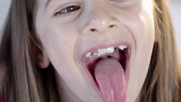 Lapsi tyttö avaa suunsa ja näyttää hänen tounge, käsite hammaslääketieteen, oikomishoito. - Materiaali, video