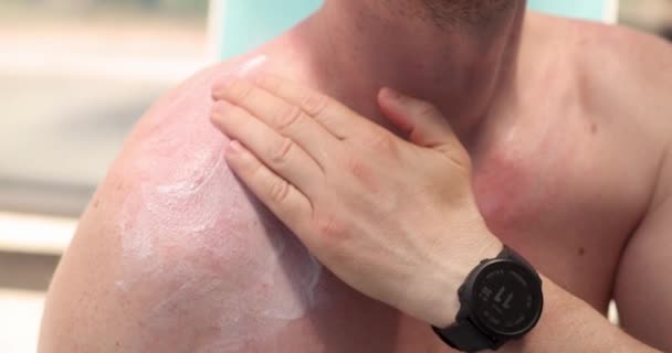 Facet nakłada krem do opalania na czerwony film o 4k. Ochrona skóry przed oparzeniami słonecznymi - Materiał filmowy, wideo
