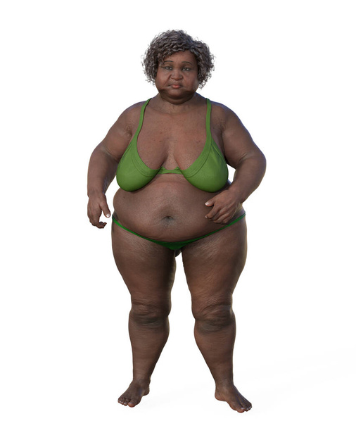 Een uitgebreide 3D-illustratie van een lichaamseigen voorstelling van een Afrikaanse vrouw met overgewicht, met de nadruk op de fysiologische implicaties van overgewicht. - Foto, afbeelding