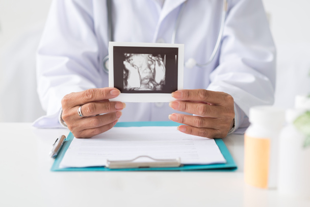 Showing ultra sound scan photo of baby - Foto, Bild
