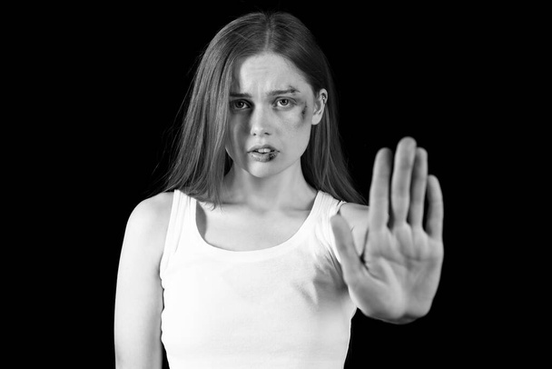 Mujer joven magullada mostrando un gesto de stop sobre fondo oscuro. Concepto de violencia doméstica - Foto, imagen