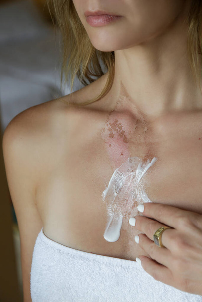 Woman applaying ointment on skin burn on her chest - Photo, Image