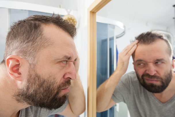 Worried adult man looking in bathroom mirror at his decreasing hairline thinking about hair care treatment - Φωτογραφία, εικόνα