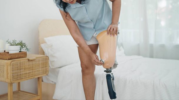 Beinamputierte, die nach dem Aufwachen Beinprothesen tragen. Schwierigkeiten im Leben behinderter Menschen, Körperbehinderung, Beinprothesen, Amputierungskonzept - Foto, Bild