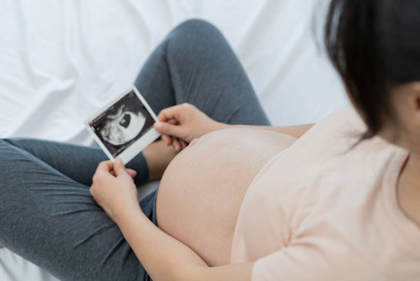 Hamile bir kadın ceninin ultrason fotoğrafına bakıyor. Anne bebeğin karnına hafifçe dokunur. Mutlu, aile, büyüme, gebelik, keyif, yeni doğan, bakım, sağlık, mide. - Fotoğraf, Görsel