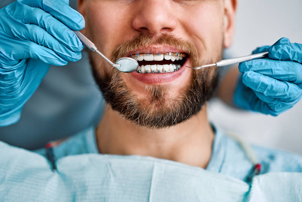 Cropped portrait of handsome man with braces sitting in dental chair. Doctor in gloves holding examination tools behind. Braces, alignment of teeth.                                - Foto, Imagen