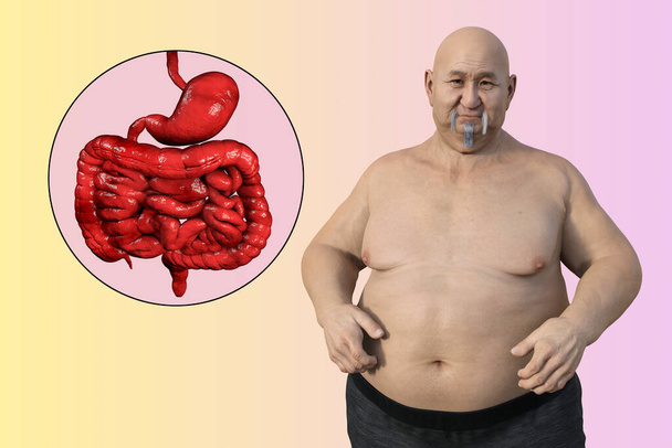 Una dettagliata illustrazione medica 3D di un uomo sovrappeso con pelle trasparente, che rivela il sistema digestivo ed evidenzia i problemi digestivi associati all'obesità. - Foto, immagini