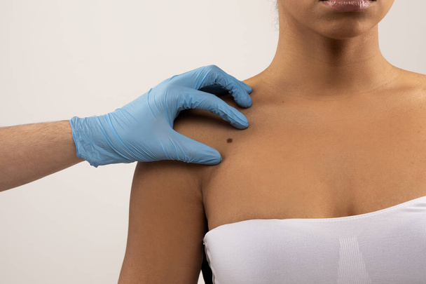 Онколог в блакитних медичних рукавичках вивчає напівголу чорну жінку шкіру в клініці, торкаючись невуса, ізольованого на сірому фоні. Поінформованість про рак, концепція онкології - Фото, зображення