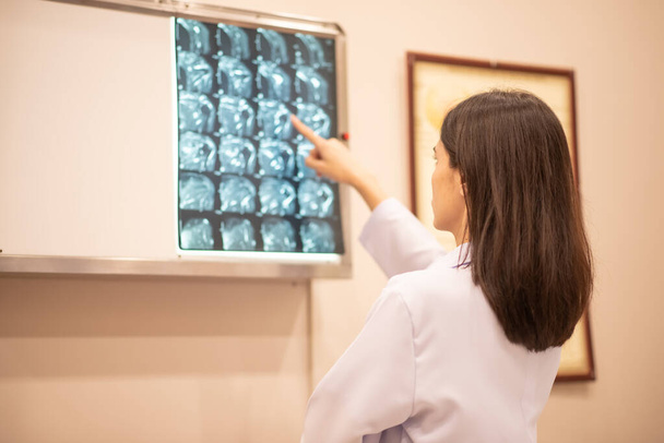 Lékařská prohlídka rentgenových snímků - Fotografie, Obrázek