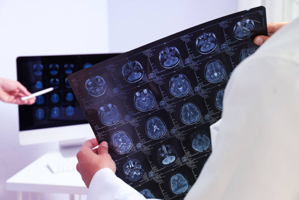 医師の手にある人間の頭のMRI画像 - 写真・画像