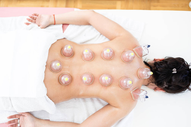 Top view of hijama cupping treatment on woman's back. - Photo, Image