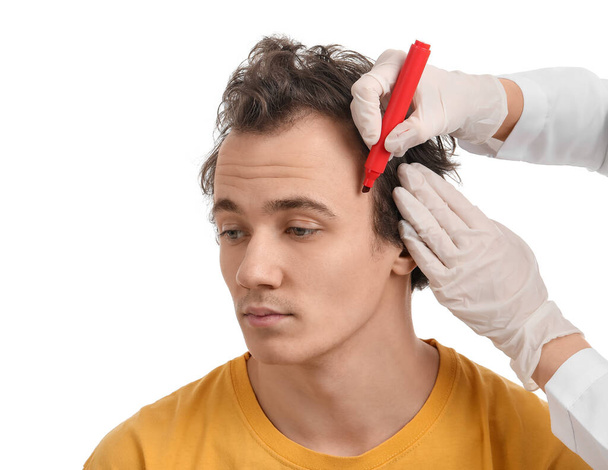Lääkäri merkintä nuoren miehen otsa hiustenlähtö ongelma valkoisella taustalla, lähikuva - Valokuva, kuva