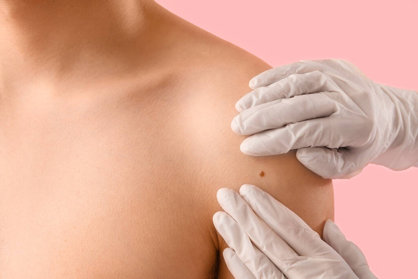 Dermatolog vyšetřuje krtka na rameni mladého muže na růžovém pozadí, detailní záběr - Fotografie, Obrázek