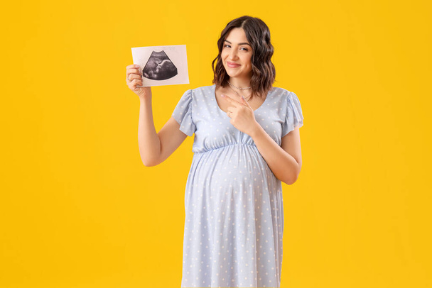Junge schwangere Frau zeigt auf Sonogramm-Bild auf gelbem Hintergrund - Foto, Bild