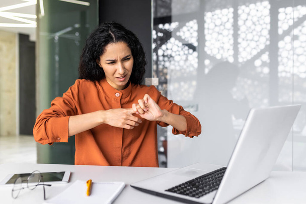 Női irodai dolgozó túlterhelt erős fájdalom az ujjak és ízületek, spanyol nő túlhajszolt a munkahelyen laptop a munkahelyen. - Fotó, kép