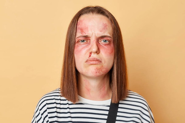 Strong woman overcoming trauma. Empowering victims of violence. Unhappy traumatized girl has problems with health has bruised skin standing isolated over beige background. - Foto, Bild
