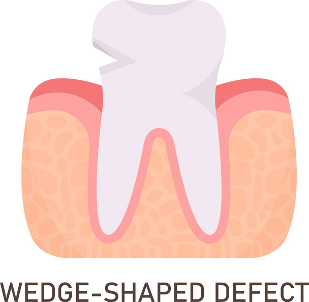 Vektorová ilustrace problému se zuby ve tvaru hrany - Vektor, obrázek