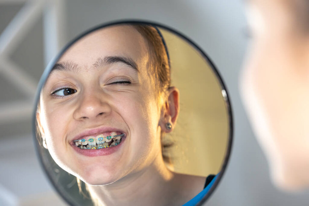 Καυκάσιος preteen κορίτσι με τιράντες στα δόντια της κοιτάζοντας τον καθρέφτη, τέλεια έννοια χαμόγελο. - Φωτογραφία, εικόνα
