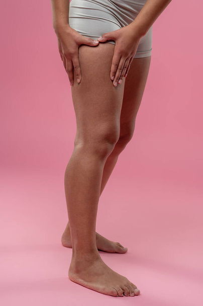Celulitis. Primer plano de la mujer comprobando sus piernas en la celulitis - Foto, imagen