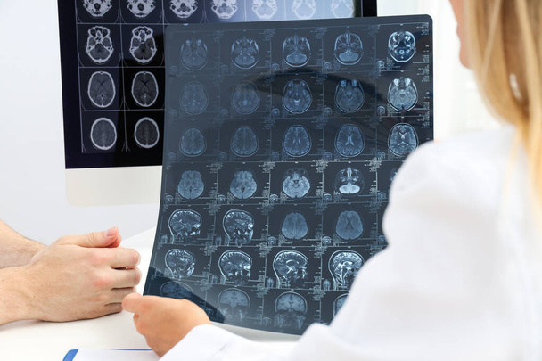 Une jeune femme médecin regarde une image IRM d'une tête humaine - Photo, image