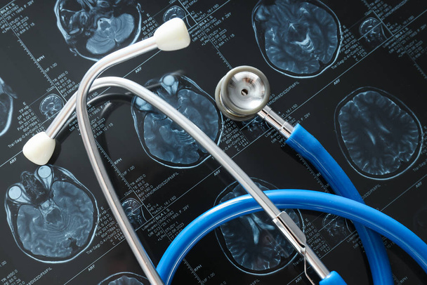 MRI or magnetic resonance imaging of the head and brain with a stethoscope. Close up - 写真・画像