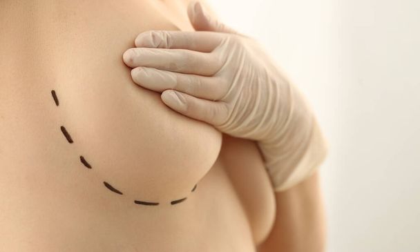 Ženská prsa označená pro plastickou chirurgii na klinice. Žena kryje poprsí s rukou zdraví a mammoplastika - Fotografie, Obrázek