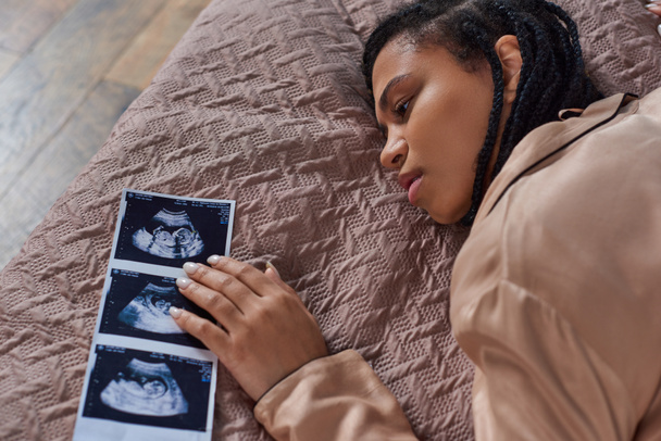 ylhäältä näkymä huolissaan afrikkalainen amerikkalainen nainen makaa sängyssä lähellä ultraääni, abortti käsite - Valokuva, kuva