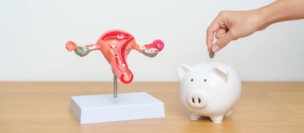 Uterus and Ovaries model with Piggy Bank for Ovarian and Cervical cancer, Cervix disorder, Endometriosis, Hysterectomy, Uterine, Reproductive, Pregnancy, Donation and Charity concept - Photo, Image