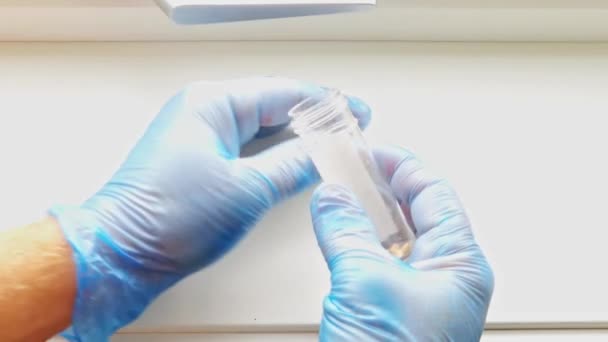 Nahaufnahme von Chirurg, der Deckel am Reagenzglas abschraubt und Gallensteine zeigt - Filmmaterial, Video