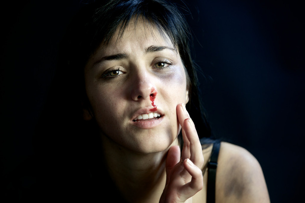Νεαρή γυναίκα αιμορραγία από τη μύτη - Φωτογραφία, εικόνα