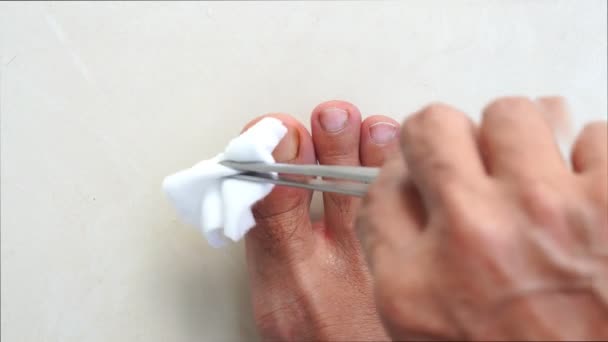 очистити рану На ногах чоловіка від нещасного випадку вдома ізольовано на білому тлі - Кадри, відео
